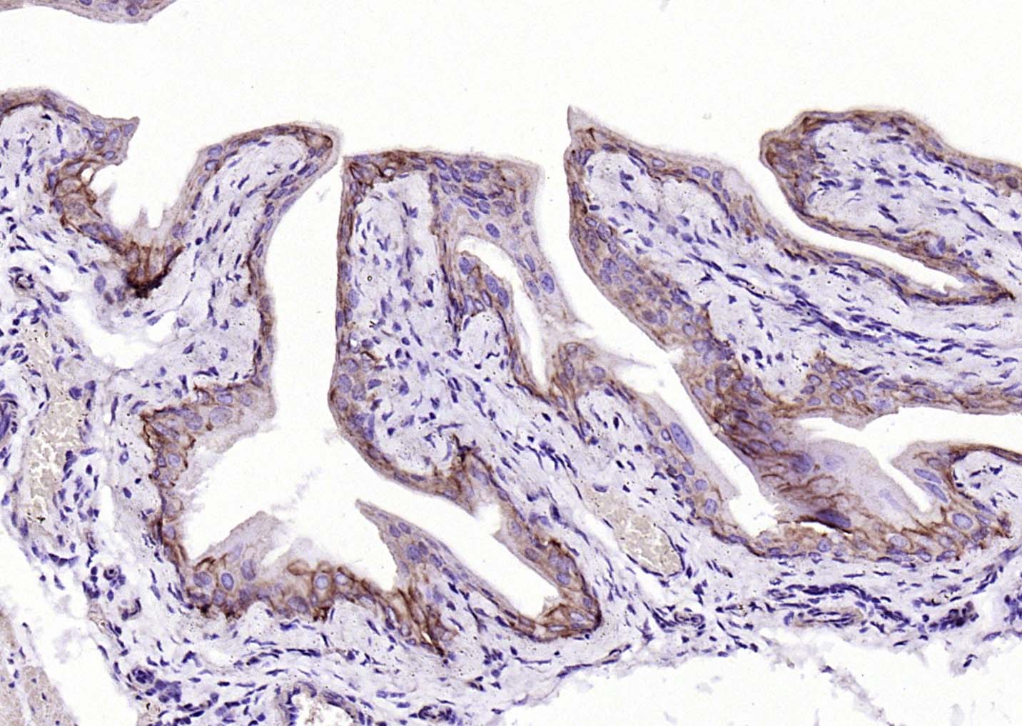 Mouse anti-Cytokeratin 19 Monoclonal Antibody