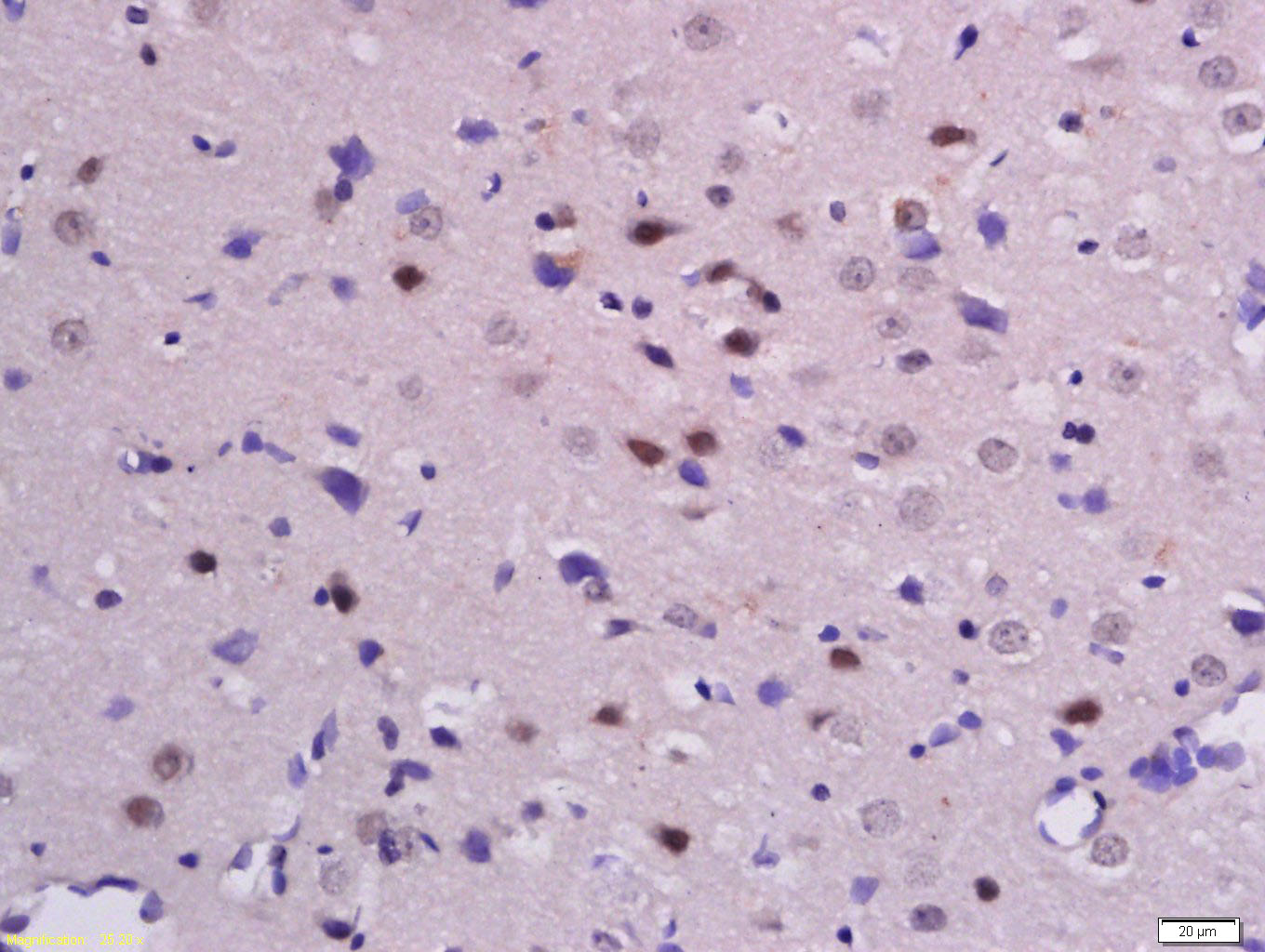 Rabbit anti-Phospho-β-Catenin(Ser33+Ser37) Polyclonal Antibody