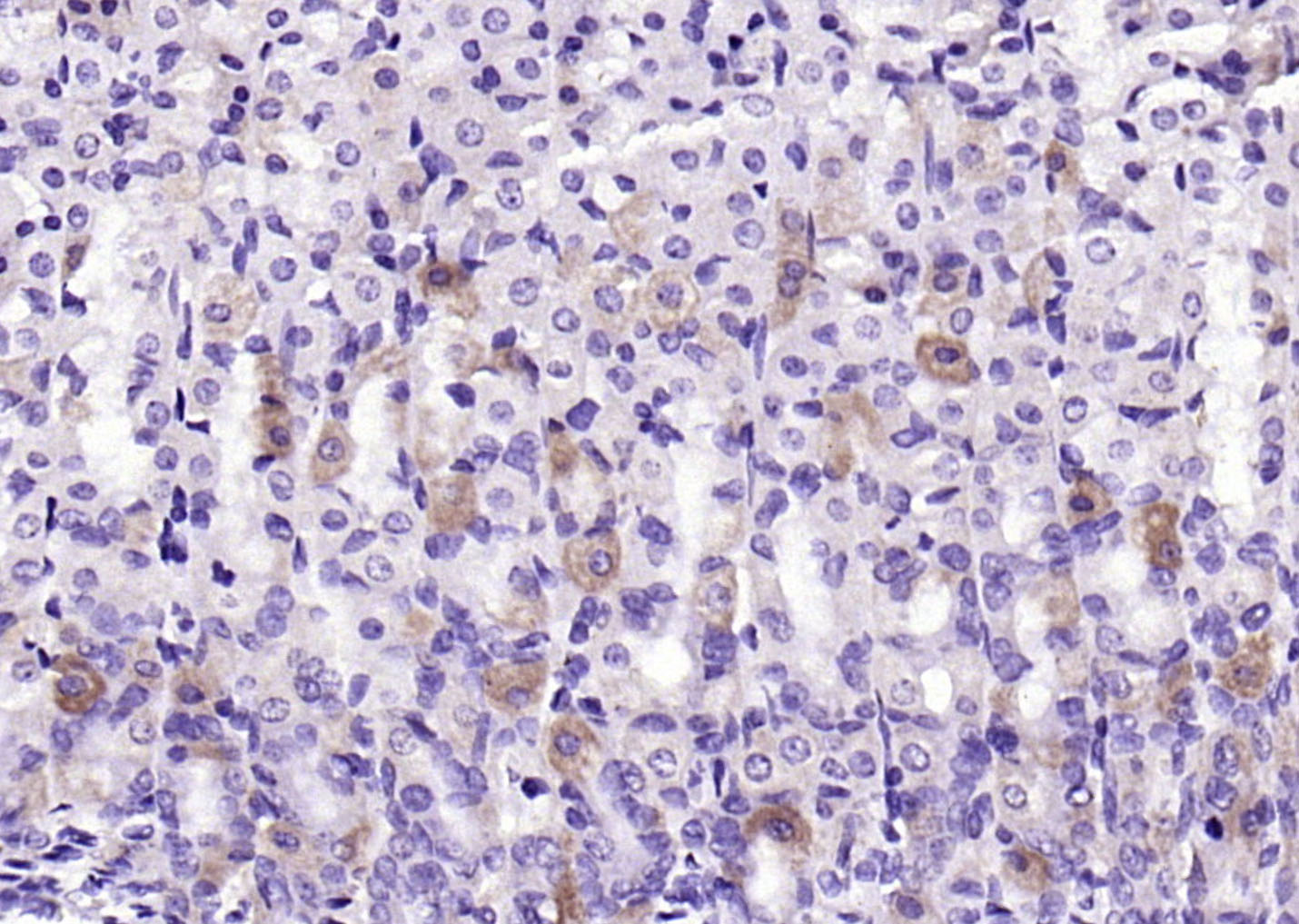 Rabbit Anti-KLHL9 Polyclonal Antibody