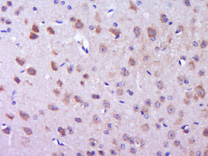 Rabbit anti-Phospho-P38 MAPK(Thr180) Polyclonal Antibody