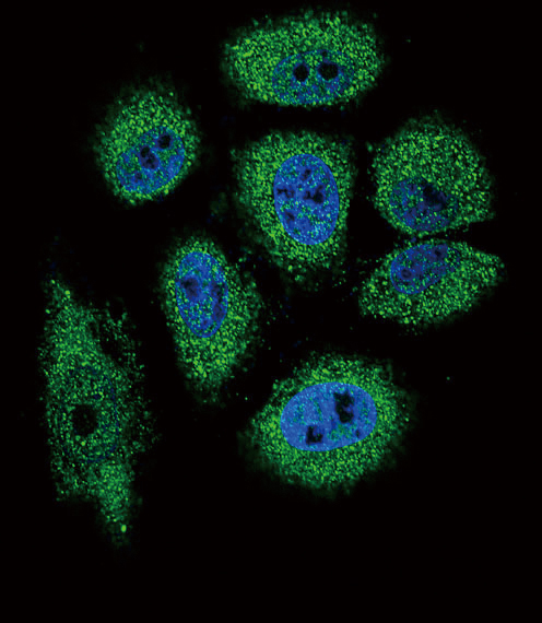 Rabbit Anti-ECP Polyclonal Antibody