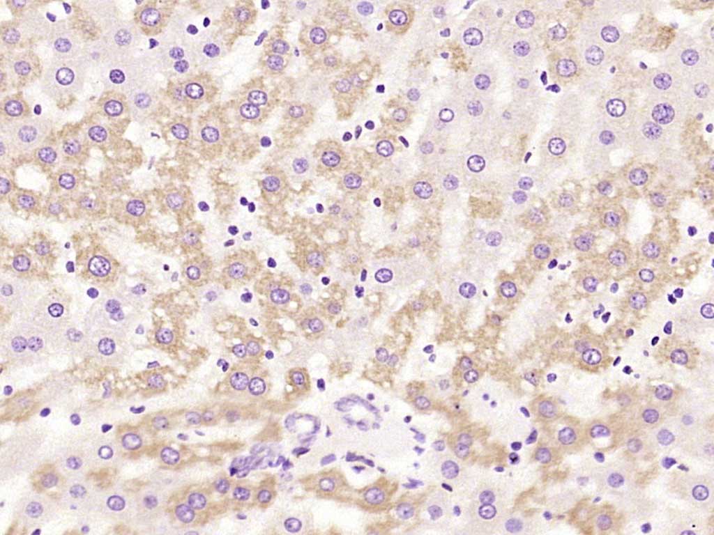 Rabbit anti-HSD17B11 Polyclonal Antibody