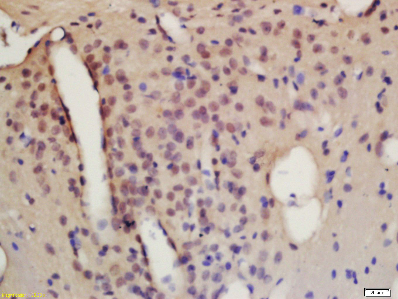 Rabbit Anti-TACC1 Polyclonal Antibody