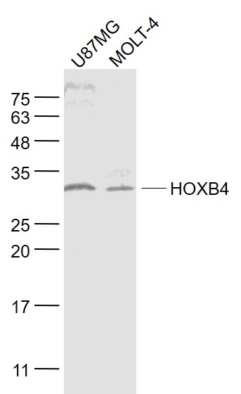 Rabbit Anti-HOXB4 Polyclonal Antibody