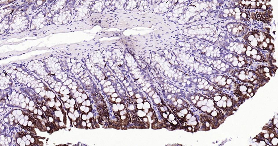 Rabbit anti-CK20 Monoclonal Antibody