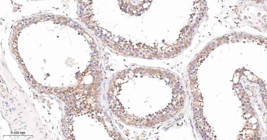 Rabbit anti-PKC δ Monoclonal Antibody