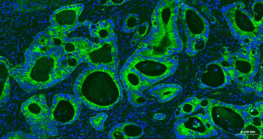 Mouse anti-Cytokeratin 19 Monoclonal Antibody