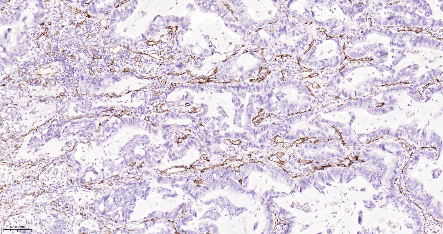 Mouse anti-CD31 Monoclonal Antibody
