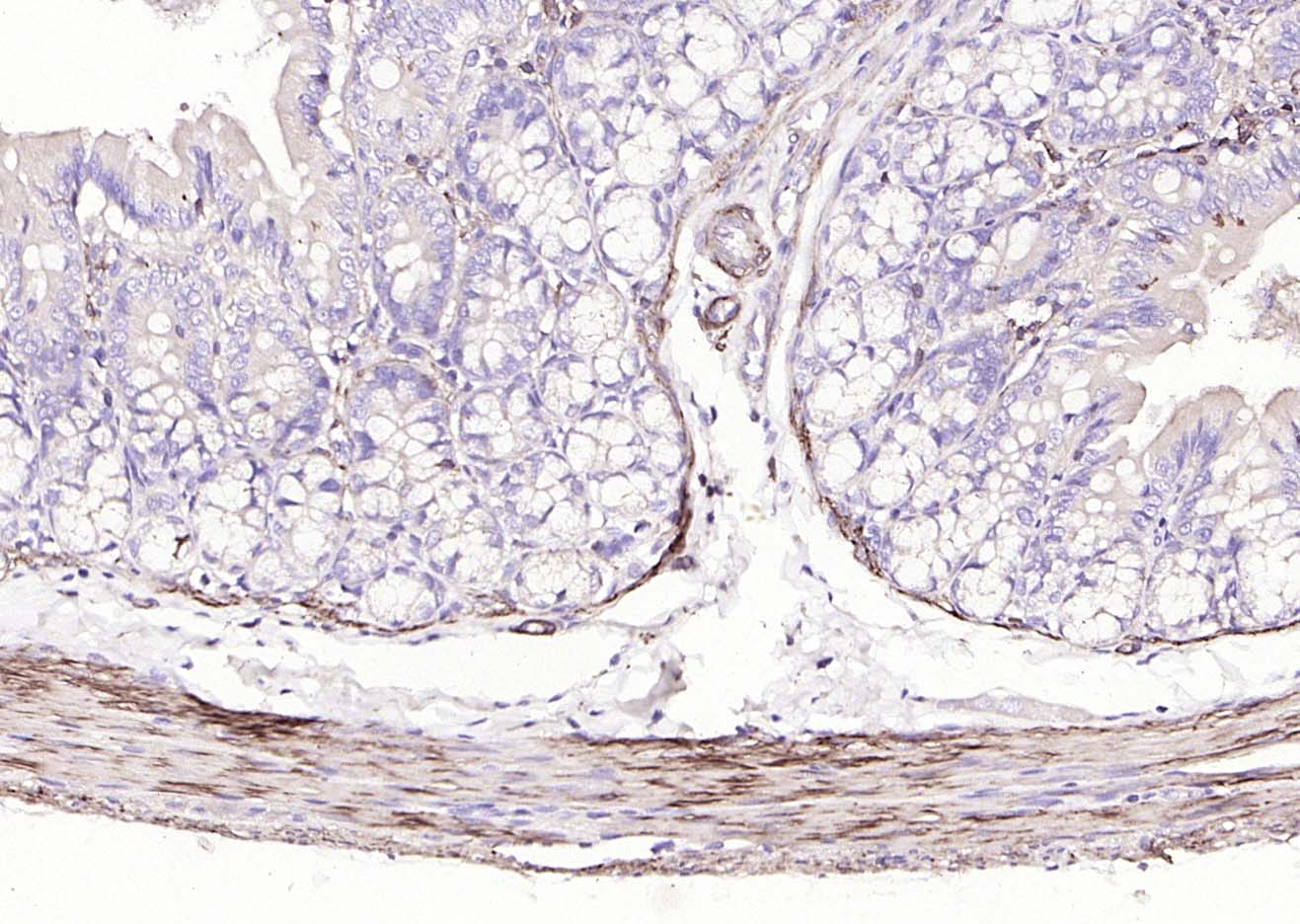 Rabbit anti-α Smooth Muscle Actin Polyclonal Antibody