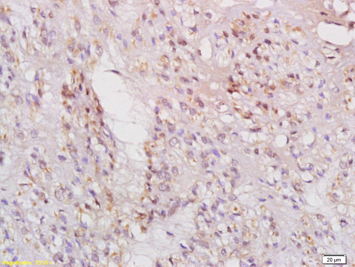 Rabbit anti-Phospho-IRS1(Ser636+Ser639) Polyclonal Antibody