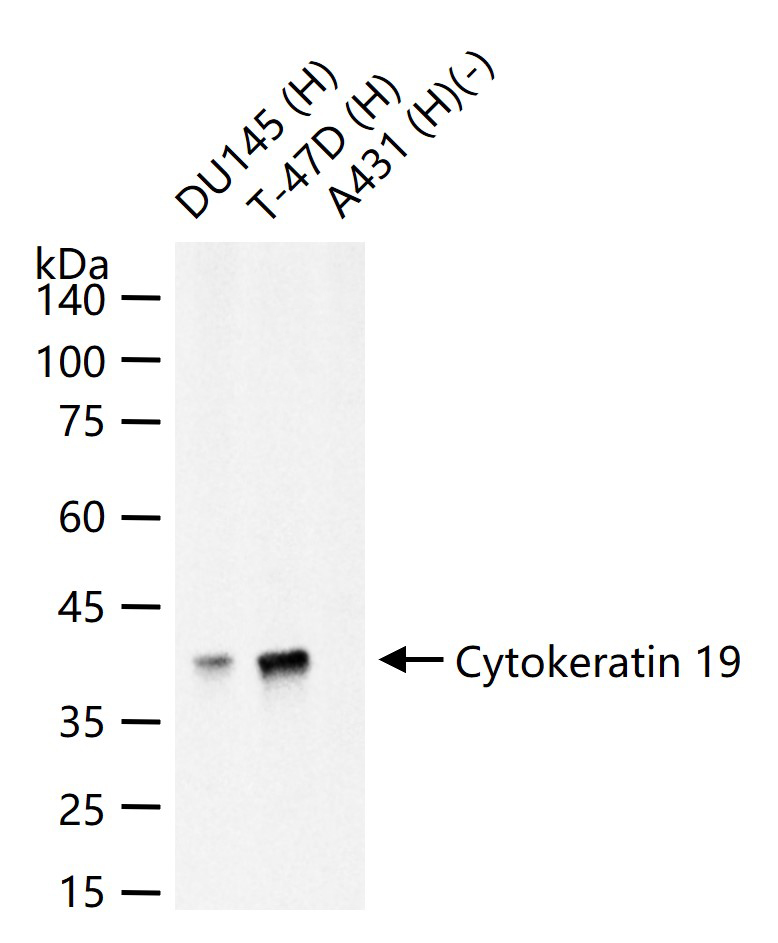 Mouse anti-Cytokeratin 19 Monoclonal Antibody
