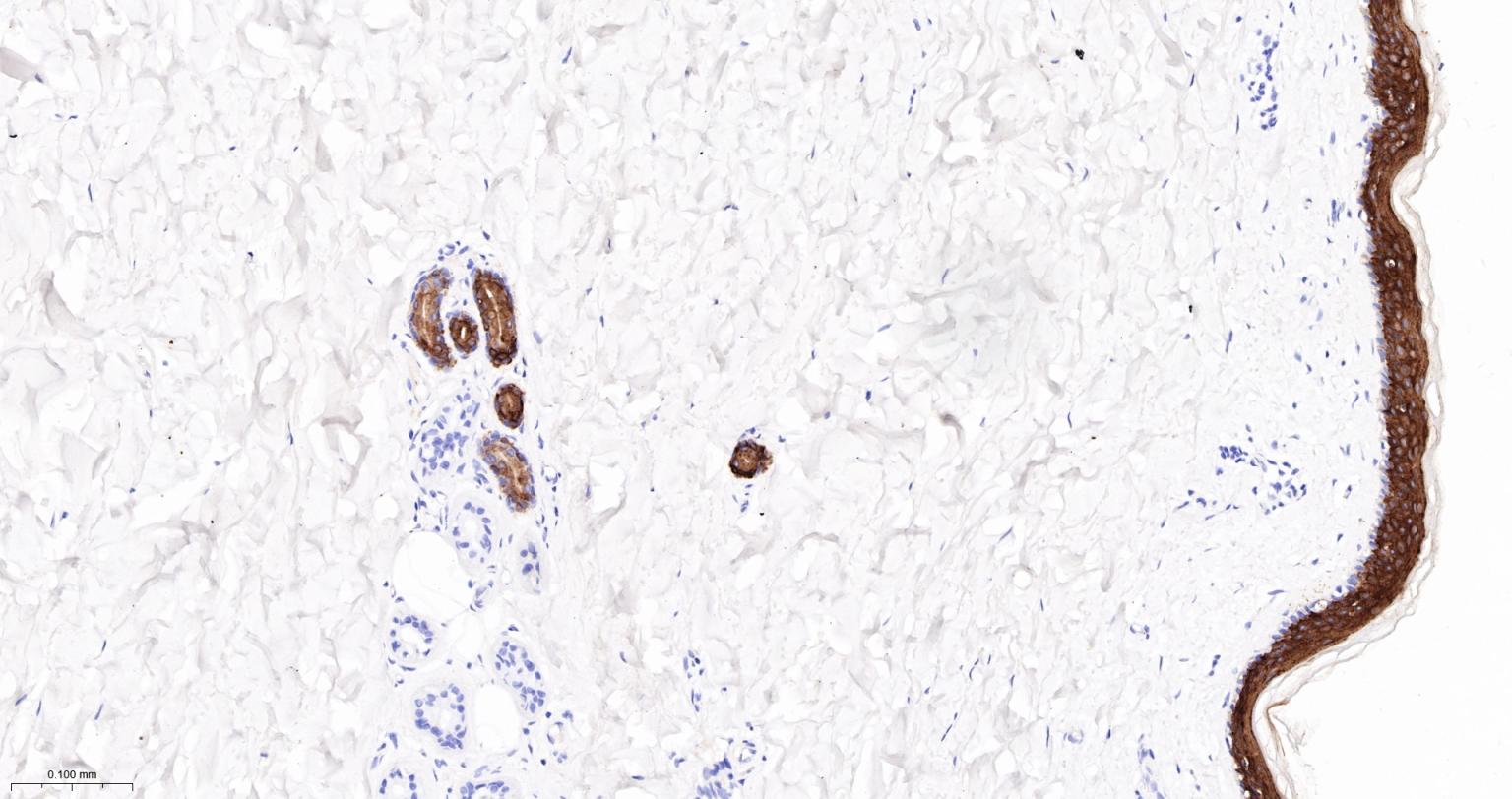 Rabbit anti-CK10/Cytokeratin 10 Monoclonal Antibody