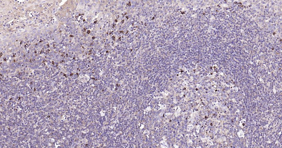 Rabbit anti-Bax Monoclonal Antibody