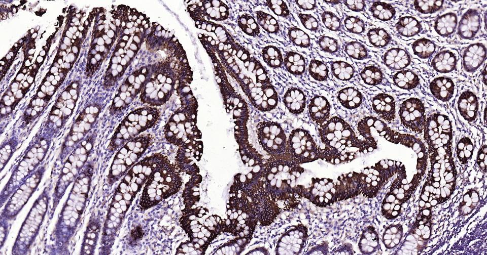 Rabbit anti-CK20 Monoclonal Antibody