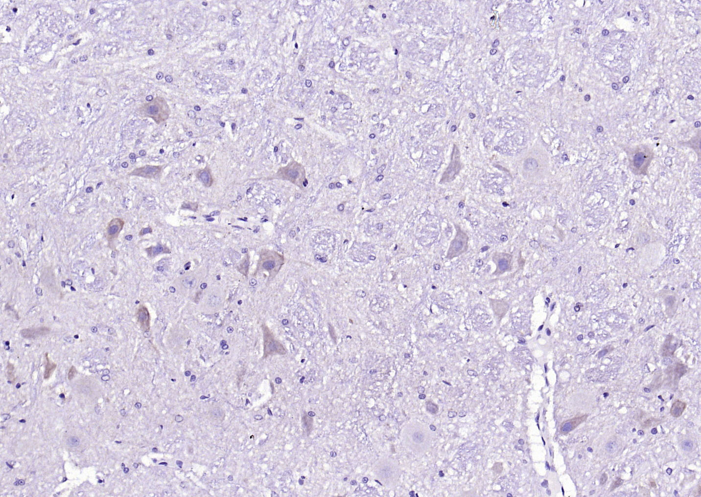 Rabbit anti-Phospho-CaMK2α(Tyr230) Polyclonal Antibody