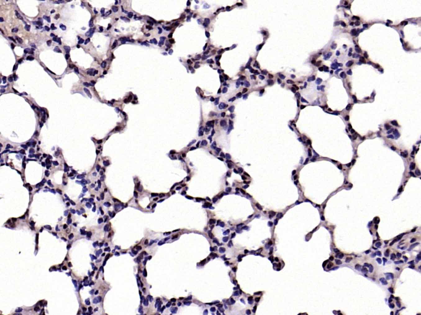 Rabbit anti-Phospho-IKB α(Ser32+Ser36) Polyclonal Antibody