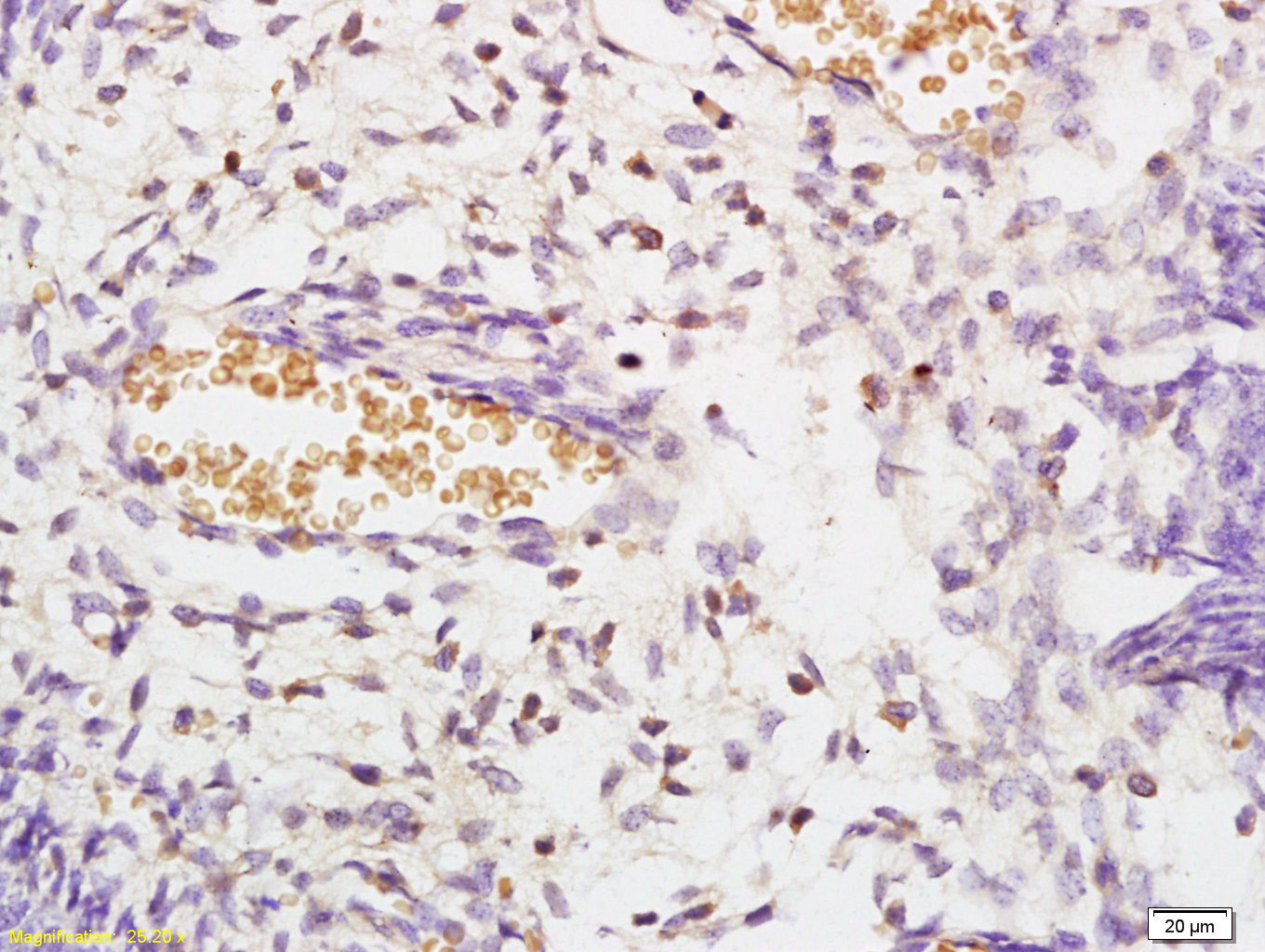 Rabbit Anti-STK3+STK4 Polyclonal Antibody