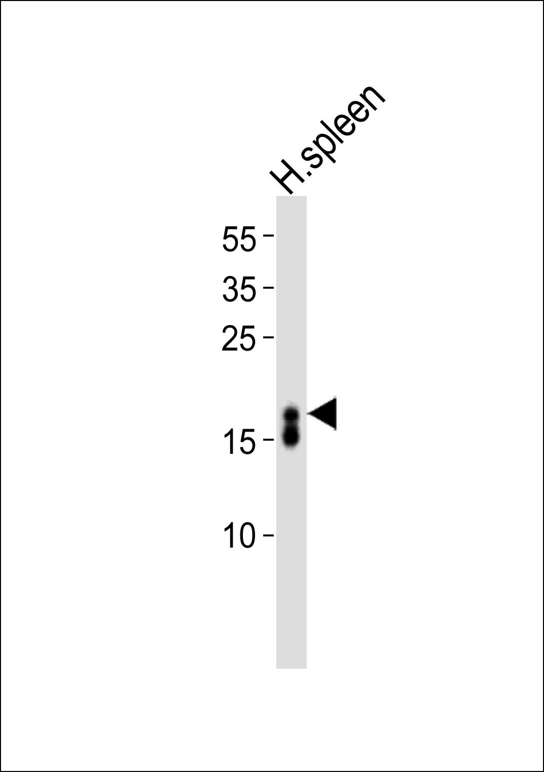 Rabbit Anti-ECP Polyclonal Antibody