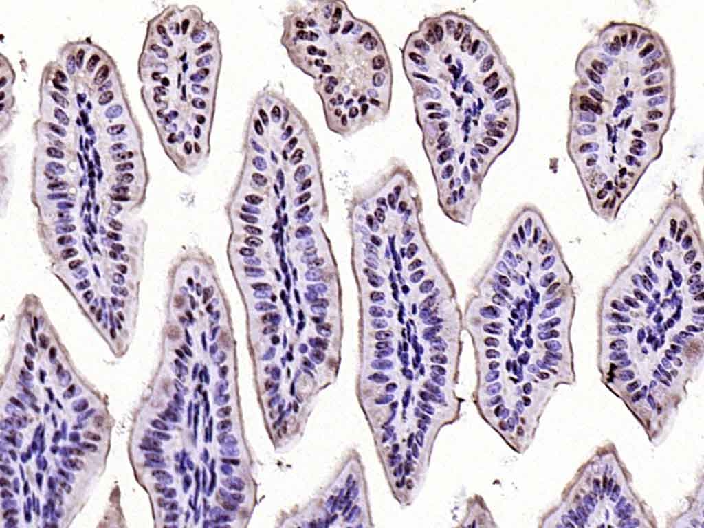 Rabbit anti-Phospho-CK18(Ser52) Polyclonal Antibody