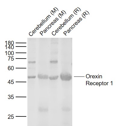 Rabbit anti-Orexin Receptor 1 Polyclonal Antibody