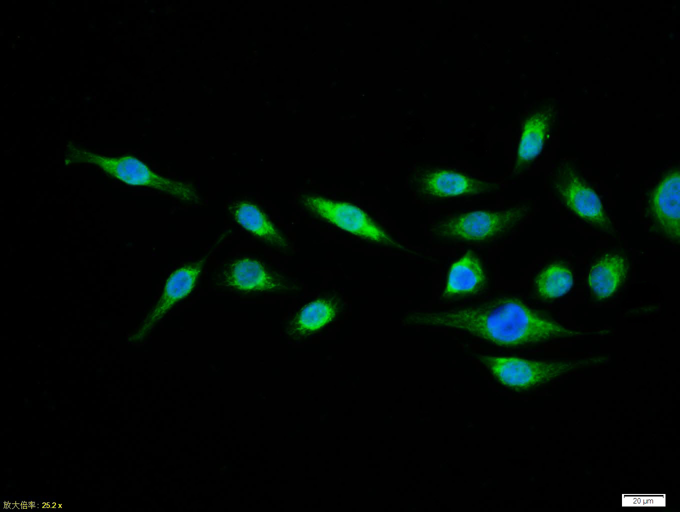 Rabbit anti-Phospho-NFKB p65(Thr435) Polyclonal Antibody