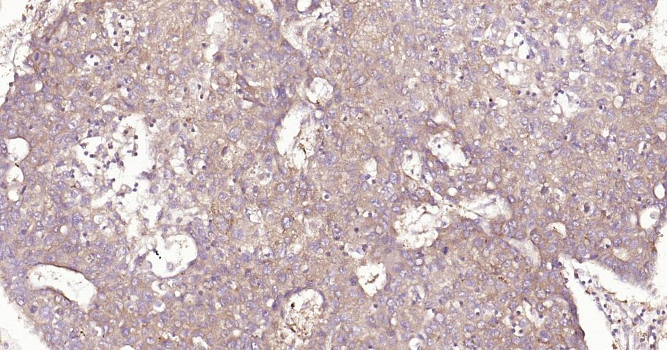 Rabbit anti-NFKB p65 Monoclonal Antibody
