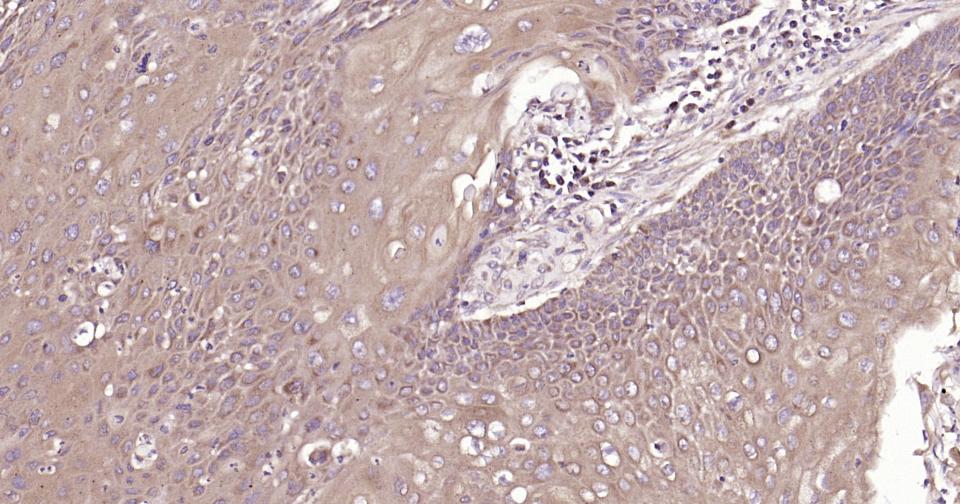Rabbit anti-Beclin 1 Polyclonal Antibody