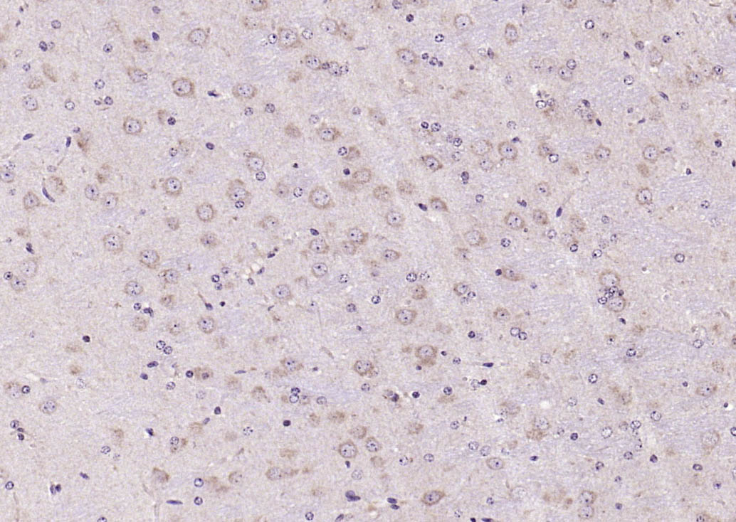Rabbit anti-Phospho-FAK(Tyr861) Polyclonal Antibody