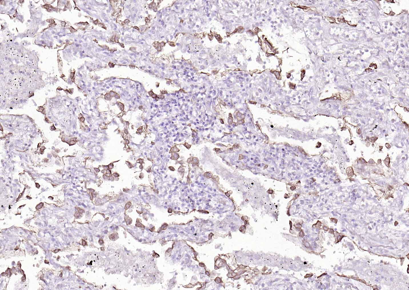 Mouse anti-Cytokeratin 8 Monoclonal Antibody
