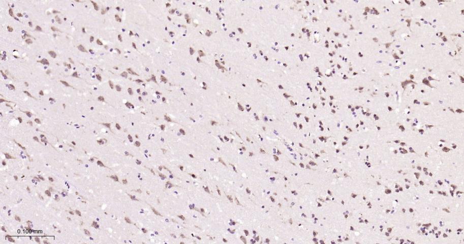 Rabbit anti-Phospho-PKR(Thr446) Monoclonal Antibody