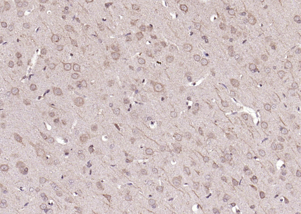 Rabbit anti-Phospho-FAK(Tyr861) Polyclonal Antibody