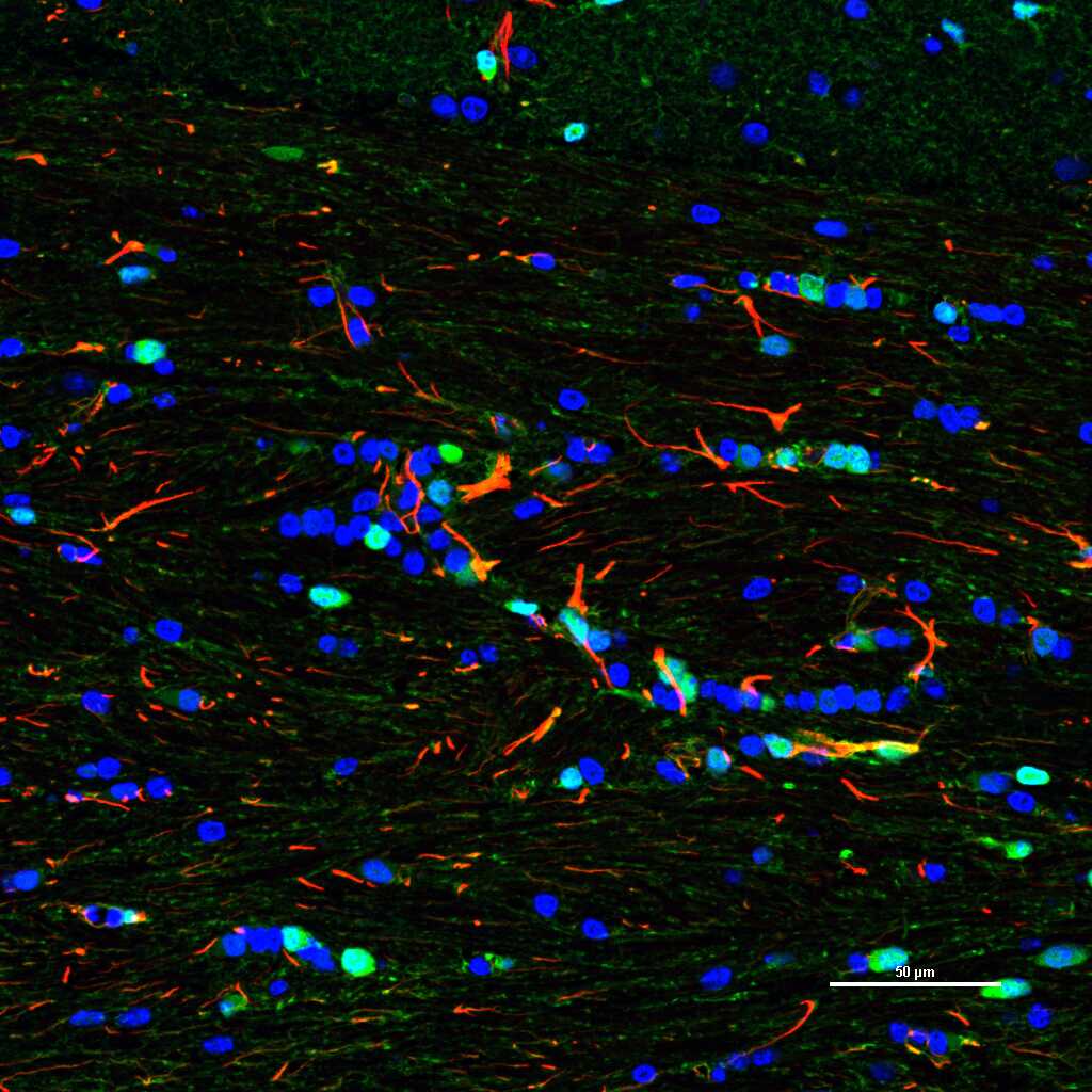 Mouse anti-S100B Monoclonal Antibody