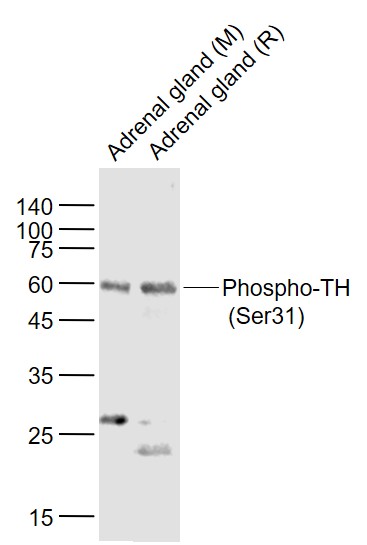 Rabbit anti-Phospho-TH(Ser31) Polyclonal Antibody