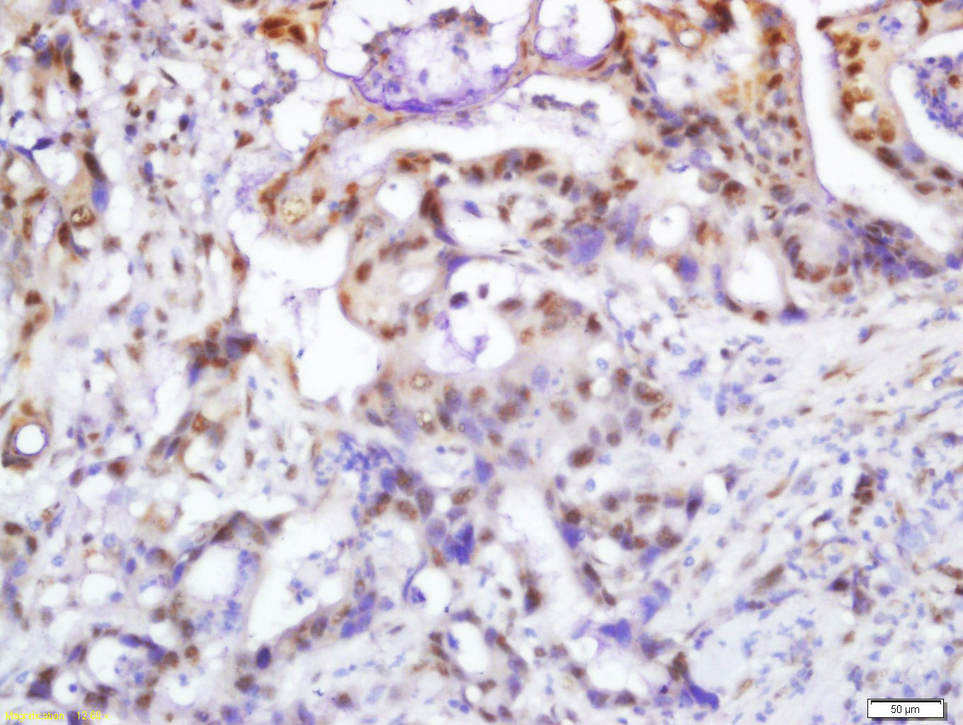 Rabbit anti-Phospho-PI3 Kinase p110 β(Ser1070) Polyclonal Antibody