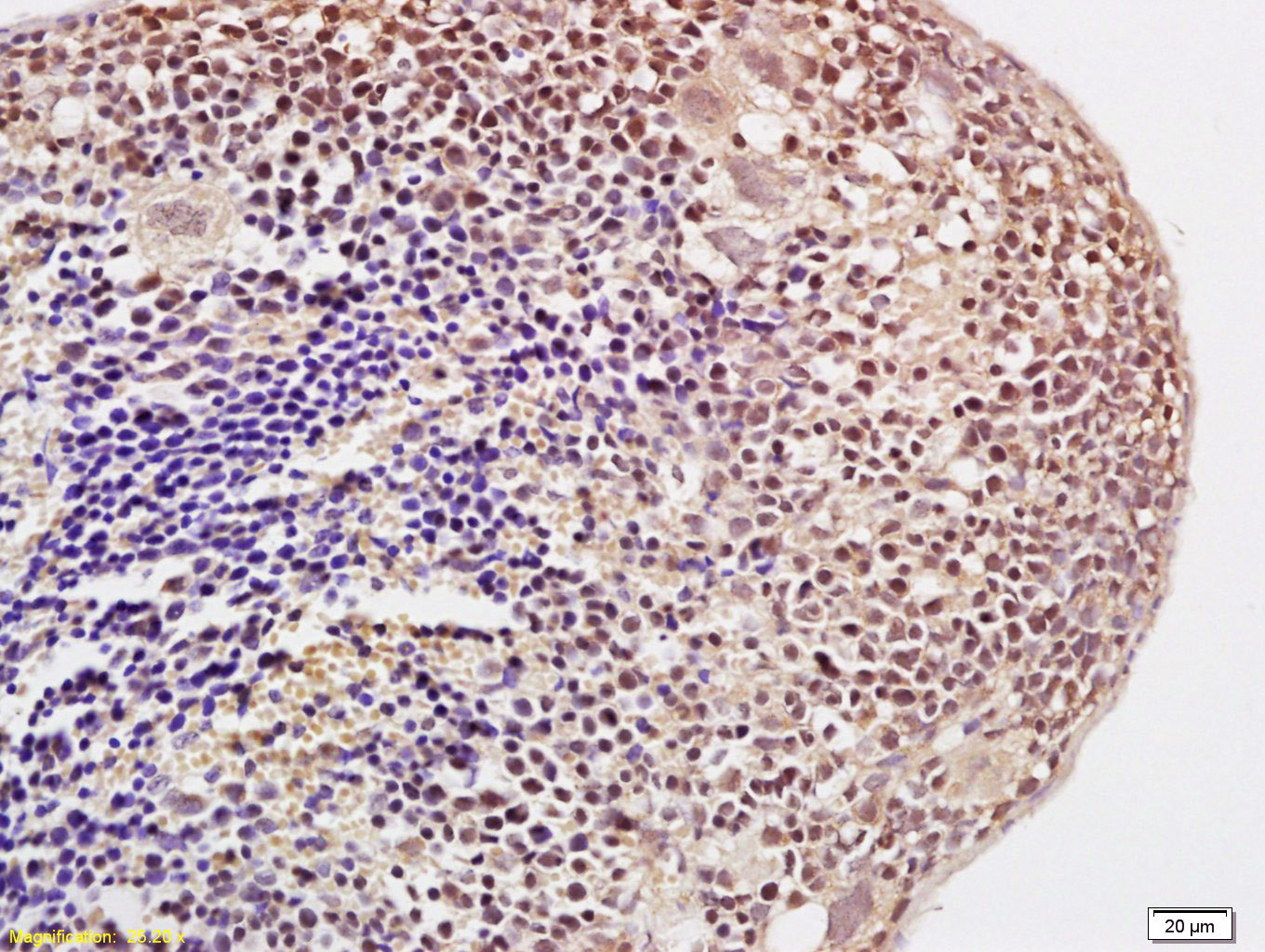 Rabbit anti-Histone H3(Acetyl K23) Polyclonal Antibody