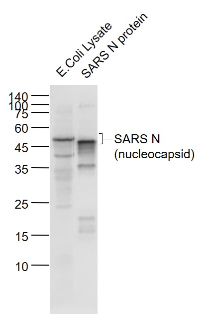 Mouse anti-SARS-CoV Nucleocapsid Monoclonal Antibody