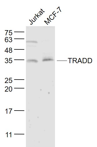 Rabbit Anti-TRADD Polyclonal Antibody