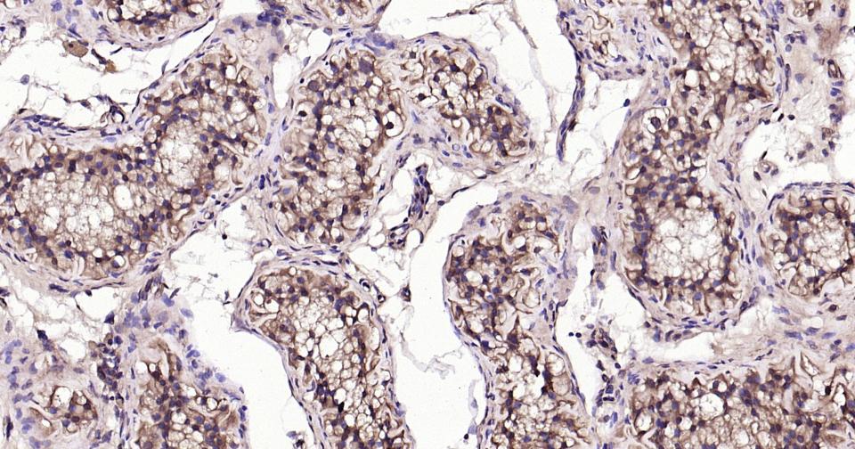 Rabbit anti-β-Tubulin Polyclonal Antibody