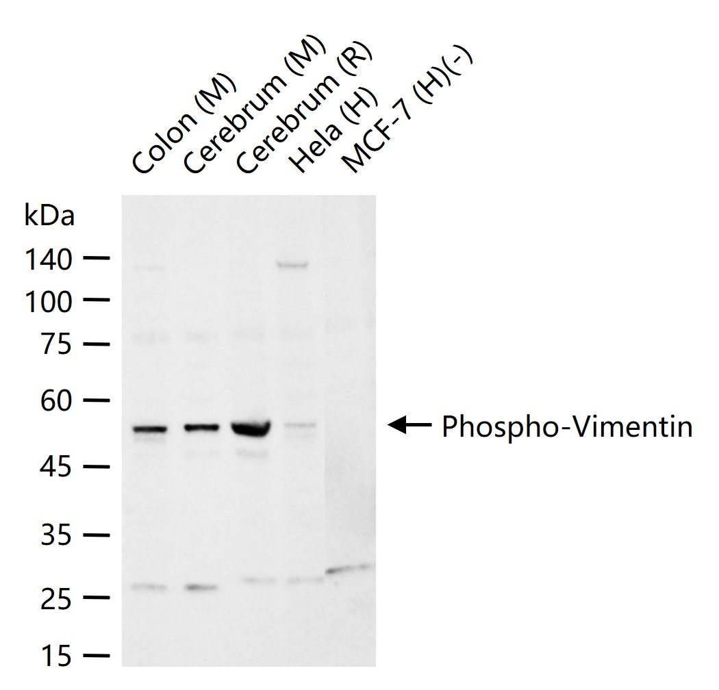 Rabbit anti-Phospho-Vimentin(Ser56) Polyclonal Antibody