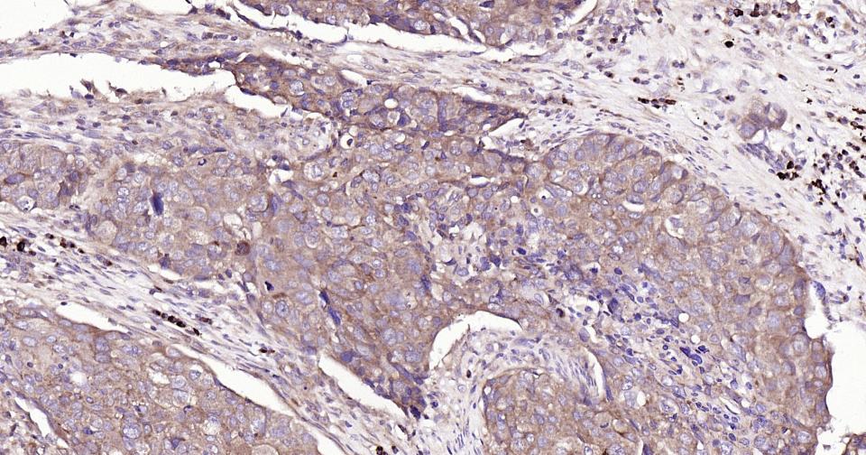Rabbit anti-Bax Monoclonal Antibody