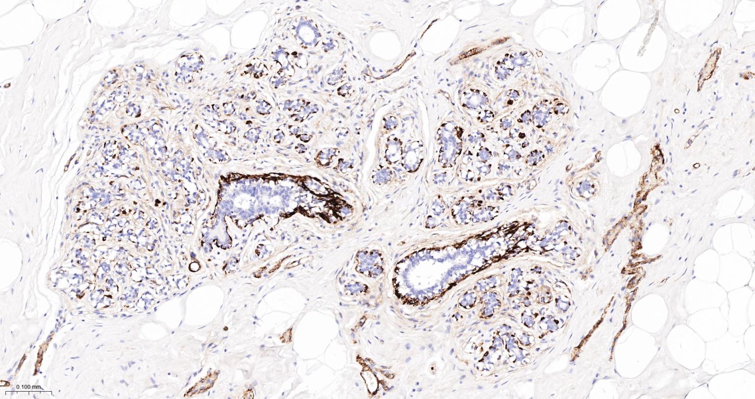 Rabbit anti-CD105 Polyclonal Antibody