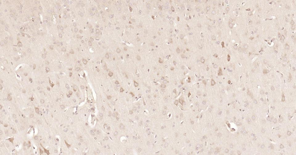 Rabbit anti-Stat3 Monoclonal Antibody