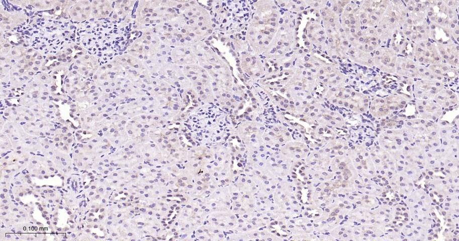 Rabbit anti-NADPH Oxidase 4 Monoclonal Antibody