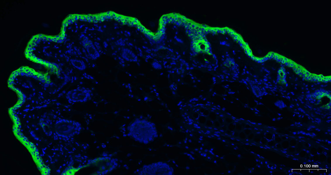 Rabbit anti-CK10/Cytokeratin 10 Monoclonal Antibody
