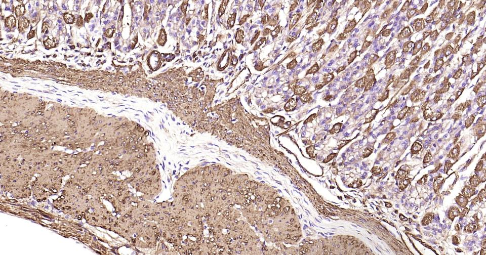 Rabbit anti-α Smooth Muscle Actin Monoclonal Antibody