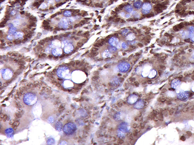 Rabbit anti-Phospho-CK18(Ser52) Polyclonal Antibody