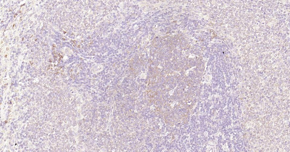 Rabbit anti-NFKB p65 Monoclonal Antibody