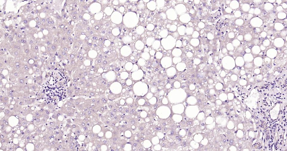 Rabbit anti-CK20 Monoclonal Antibody