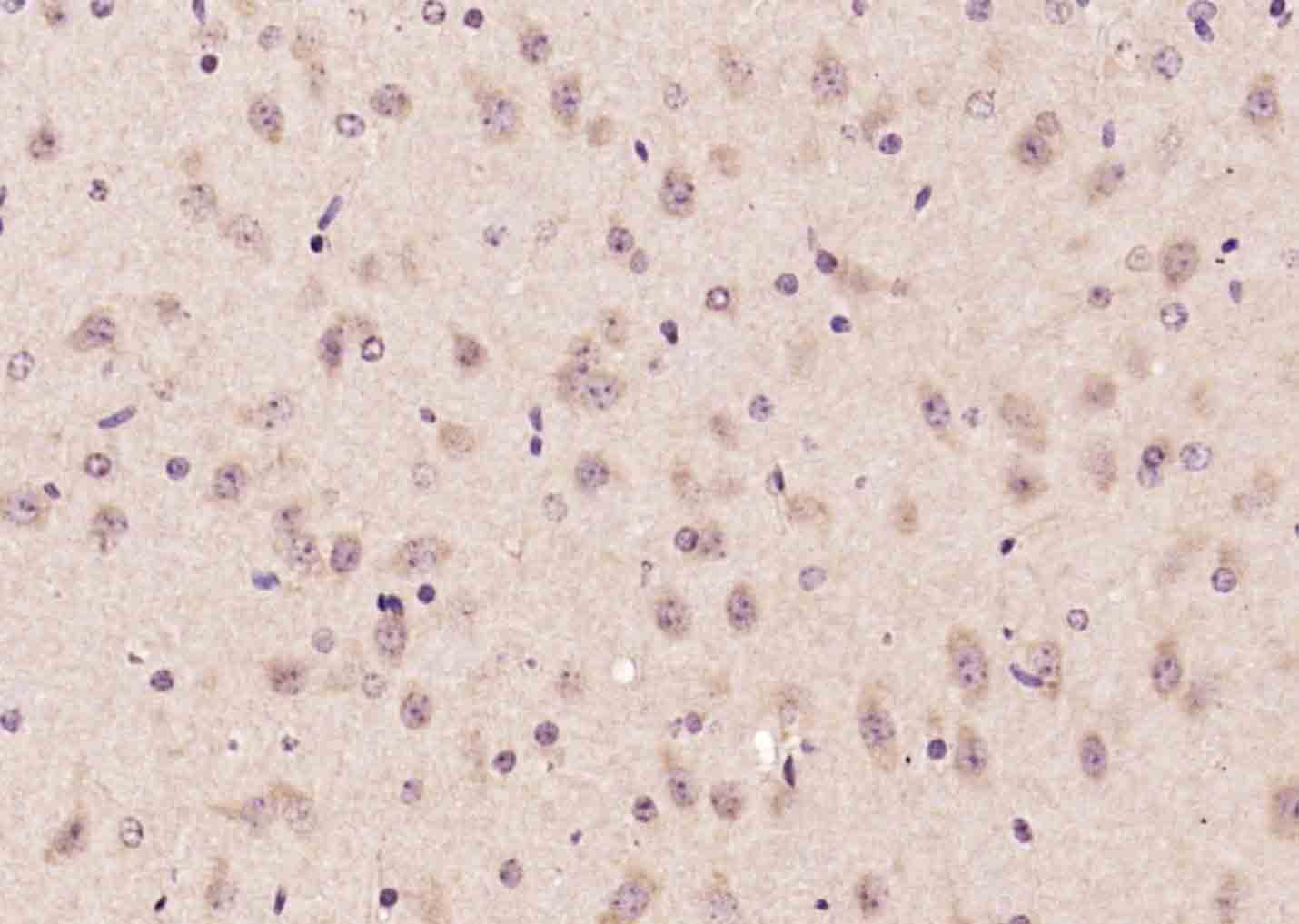 Rabbit Anti-Advillin/AVIL Polyclonal Antibody