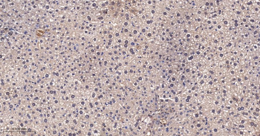 Rabbit anti-TSG101 Monoclonal Antibody